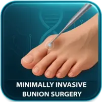 Bunion Surgery