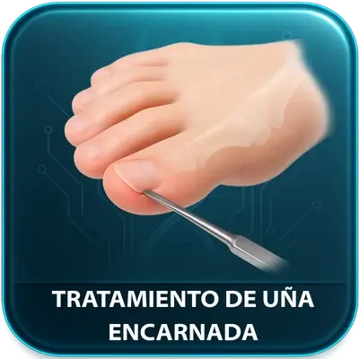 Tratamiento de Uñas Encarnadas